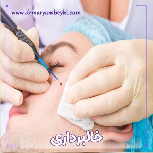 خالبرداری - دکتر مریم بیکی