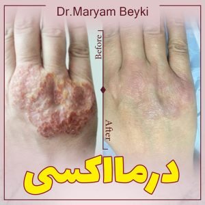 درمااکسی تراپی دکتر مریم بیکی در اراک