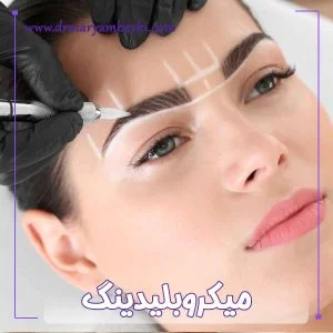 میکروبلیدینگ در اراک - دکتر مریم بیکی