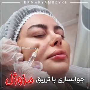 مزوژل