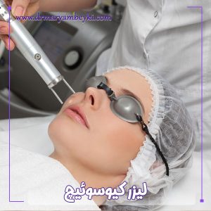 لیزر کیوسوئیچ در اراک - دکتر مریم بیکی