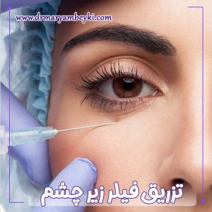 تزریق فیلر زیر چشم در اراک - دکتر مریم بیکی