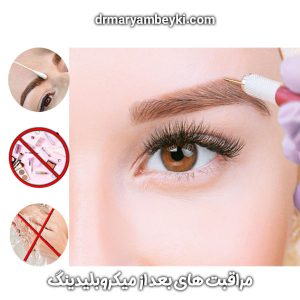 مراقبت-های-بعد-از-میکروبلیدینگ