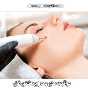 مراقبت های بعد از برداشتن خال دکتر بیکی در دلیجان اراک