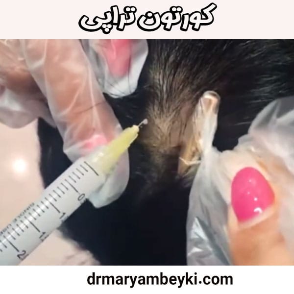 کورتون تراپی از دکتر مریم بیکی در دلیجان