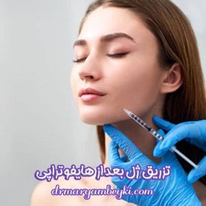 تزریق ژل بعد از هایفوتراپی