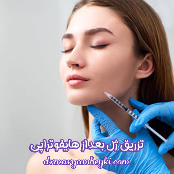 تزریق ژل بعد از هایفوتراپی