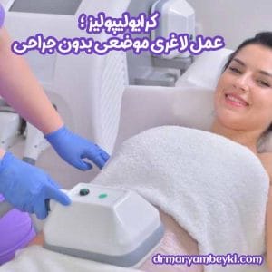 کرایولیپولیز