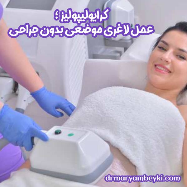 کرایولیپولیز