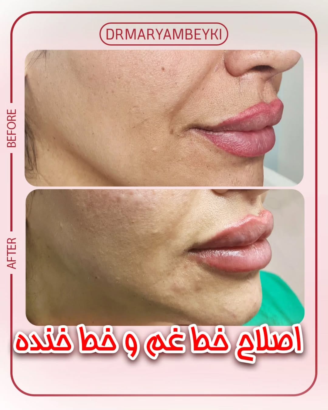 عکس نمونه کار بهترین دکتر زیبایی دلیجان