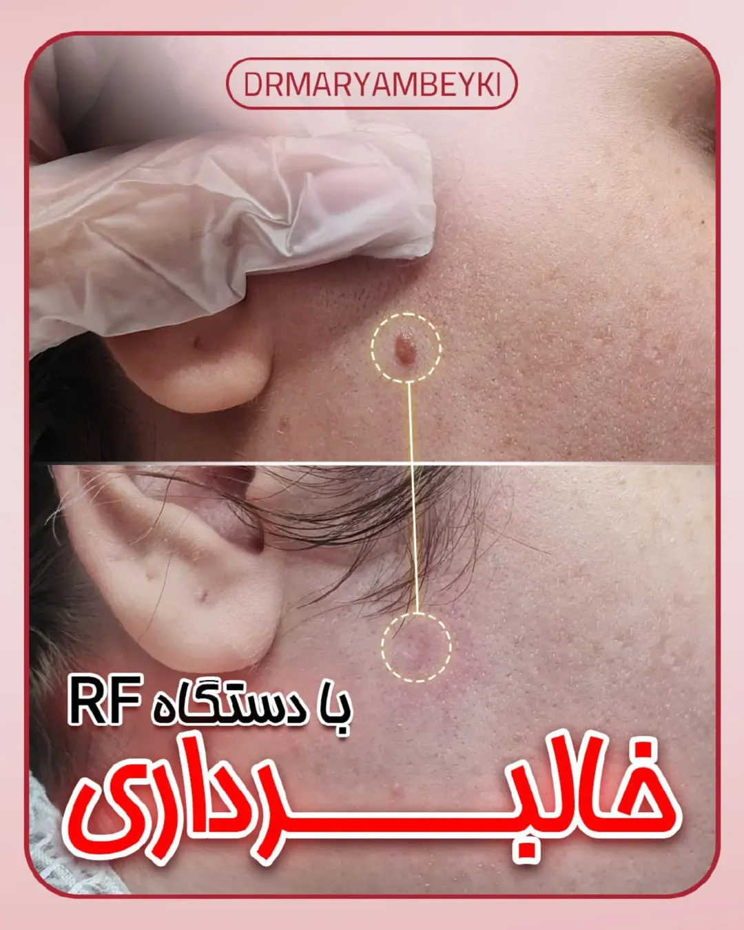 عکس نمونه کار بهترین دکتر زیبایی دلیجان