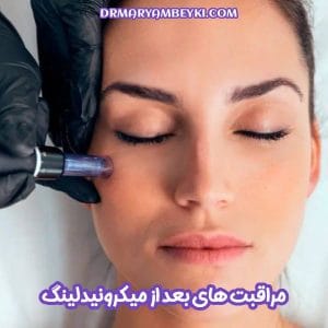 مراقبت های بعد از میکرونیدلینگ