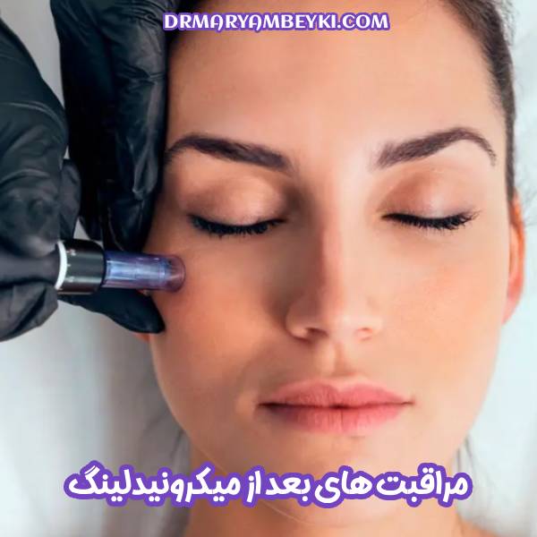 مراقبت های بعد از میکرونیدلینگ