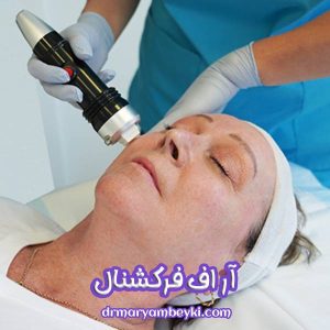 آر اف فرکشنال