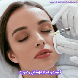 کبودی بعد از مزوتراپی صورت